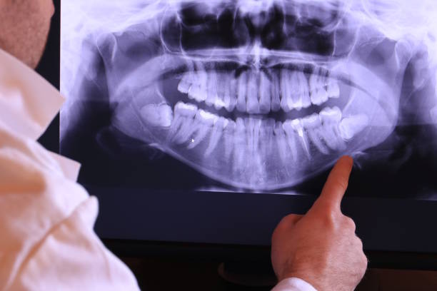 Best Emergency Dentist for Knocked-Out Tooth in Brickerville, PA
