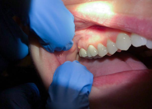 Best Emergency Root Canal Treatment in Brickerville, PA